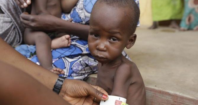 MALNUTRITION IN NIGERIA